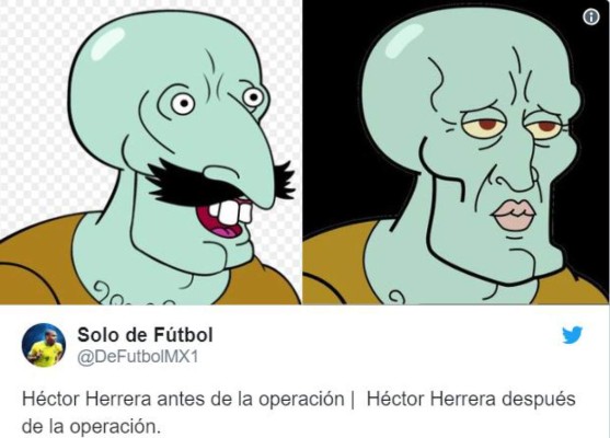 Despiadada ola de memes contra Héctor Herrera tras su cirugía en nariz y orejas