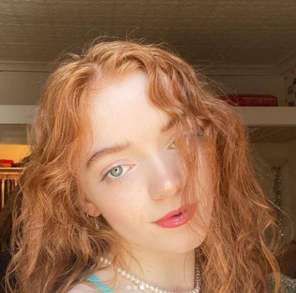 Orla Baxendale, la modelo de 25 años que murió tras comer una galleta