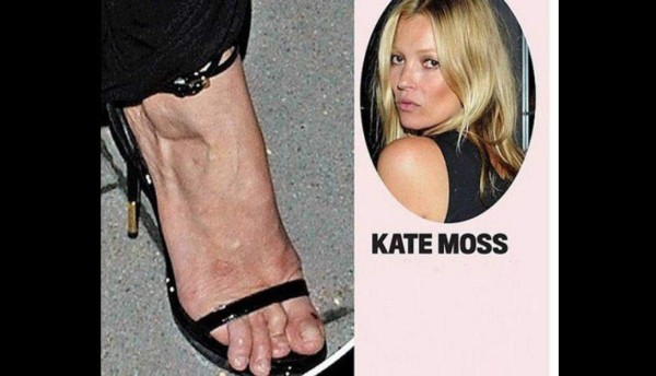 Las 10 famosas con los pies más feos