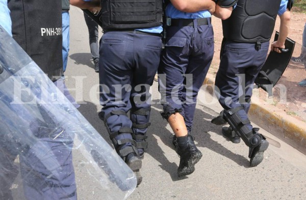 Fotos: Así terminaron quemados cuatro policías tras violento enfrentamiento con miembros del MEU