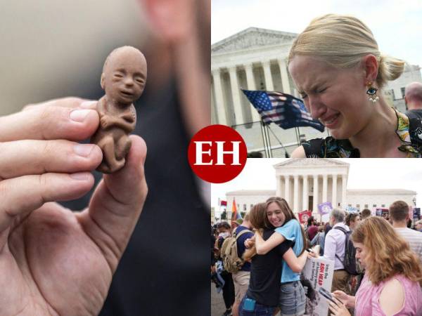 La Corte Suprema de Estados Unidos eliminó el derecho que reconocía de una mujer poder tener un aborto y ahora dependerá de cada estado tomar la decisión. Esto es lo que debes saber sobre el tema.