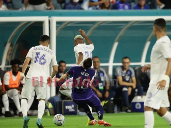 Deybi Flores desató la polémica en el duelo amistoso de esta noche en Miami.