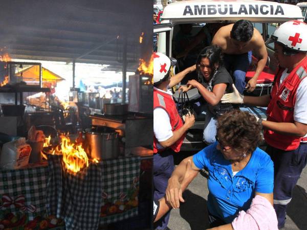 Más de 70 personas, entre niños, adultos y personas de la tercera edad, resultaron quemadas por la mortal mezcla del gas disperso y el fuego de las hornillas. A consecuencia de la explosión registrada en el mayoreo del estadio en 2015. Recordamos la tragedia que enlutó a Tegucigalpa y exigió un mayor control del uso de chimbos, controles que se practican a medias.