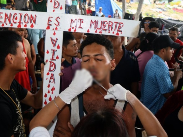 Entre los migrantes había hondureños y venezolanos, quienes decidieron coser sus labios en forma de protesta.