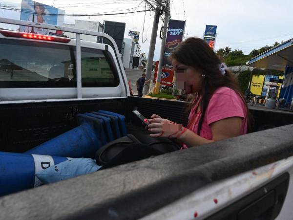 La otra joven que resultó herida en el conflicto durante la manifestación.