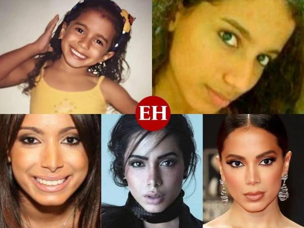 La cantante Larissa de Macedo Machado, mejor conocida como Anitta, se suma a las mujeres famosas que no temen aceptar ante el público que se han hecho cirugías plásticas. La brasileña decidió hablar con mucha naturalidad sobre el tema, pero ¿cómo se veía antes de todos estas intervenciones estéticas? Mira a continuación.