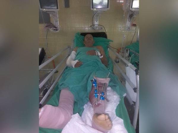 Don Eduardo, de 75 años, sufrió fracturas en la mano y brazo derecho, fractura de tibia y peroné en la pierna izquierda, así como lesiones en ambas rodillas que requieren de cirugía y otra lesión en la mano que también necesita operación.