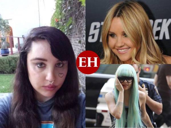 Amanda Bynes fue una de las estrellas infantiles más populares, pero el exceso de drogas, inseguridades por su apariencia y la fama a corta edad le pasaron factura. Ahora la actriz vive con su prometido y se mantiene sobria.