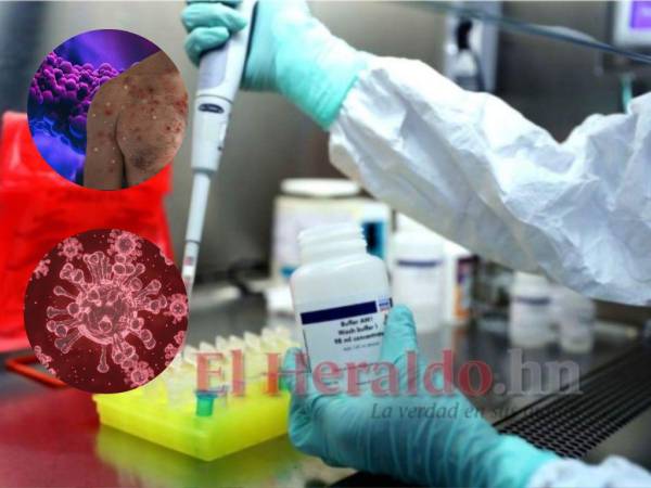 El coronavirus infectó y sigue infectando a millones de personas en el mundo, la OMS pide a la población extremar las medidas de protección.