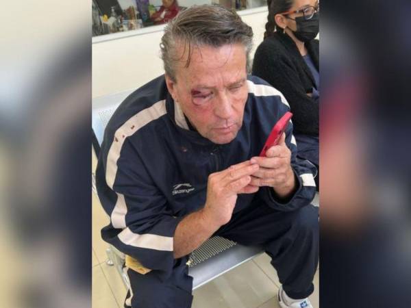 El también actor de telenovelas resultó fuertemente herido luego del ataque.