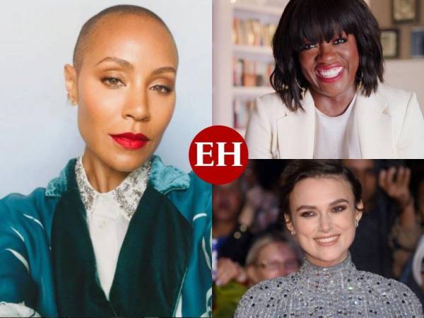 Los tratamientos para el cabello, el estrés y las hormonas han provocado que estas famosas sufran alopecia femenina. Jada Pinkett Smith no es la única en Hollywood o en el mundo del entretenimiento que se enfrenta a este padecimiento.