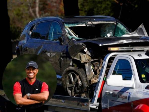 Woods sufrió lesiones graves en las piernas cuando la camioneta que conducía se volcó en una carretera del condado de Los Ángeles. Foto:AP