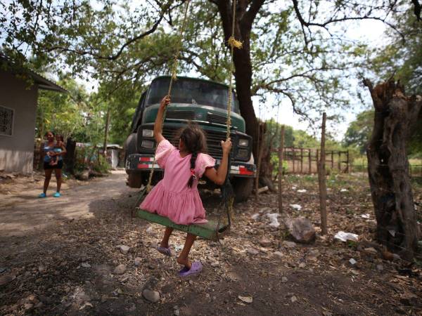 Génesis es una de los cientos de niños que nacieron con microcefalia hace siete años en Honduras debido a la epidemia del zika. Su madre contrajo el virus durante el embarazo.