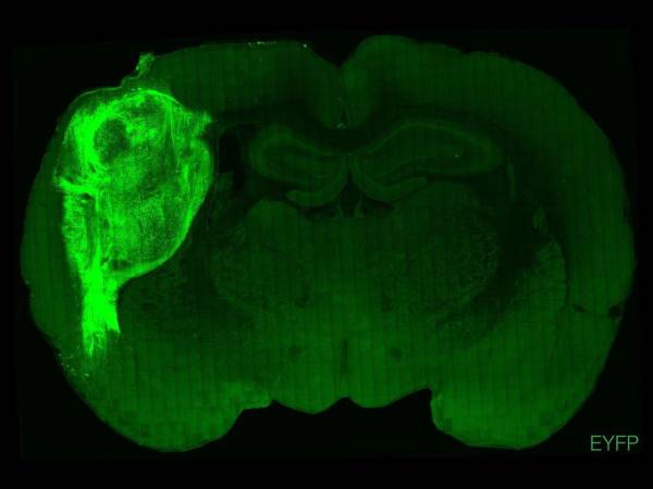 Una imagen sin fecha publicada por la Universidad de Standford el 12 de octubre de 2022 muestra el cerebro de una rata en la que se ha utilizado una proteína fluorescente para resaltar las células cerebrales humanas trasplantadas.