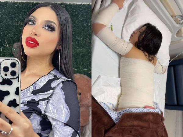 La famosa mexicana Yeri Mua ha estado en tendencia en redes sociales en las últimas horas debido a su polémica con un video íntimo y por revelar que en el pasado anduvo con un hondureño. La joven es admirada por su forma de ser y belleza, por lo que muchos se preguntan ¿cómo lucía previo a sus cirugías estéticas? En esta galería las sorprendentes imágenes.