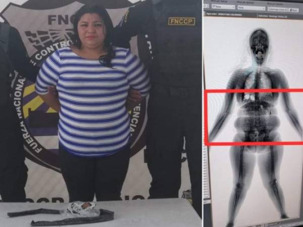 En el escáner se observaba que la mujer llevaba algo extraño dentro del cinturón. Foto: EL HERALDO