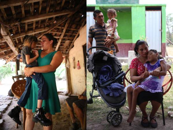 El equipo de EL HERALDO Plus conoció de primera mano las historias de estos hijos del zika. Sus padres han tenido que dejar sus trabajos para poder cuidar de ellos y algunos aún siguen esperando las promesas que alguna vez les hicieron. Estas son sus historias no contadas.