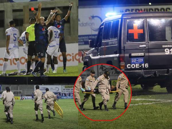 El jugador de Motagua, Carlos Argueta, recibió un duro golpe por parte de un futbolista del Victoria. Todos llamaban al personal médico