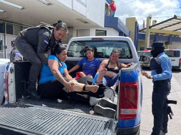 Al Hospital Escuela en la capital fueron trasladadas las primeras heridas que dejó la reyerta en al interior del Centro Femenino de Adaptación Social (Cefas) en Támara, Francisco Morazán. En una patrulla policial y con resguardo policial, una a uno ingresó al máximo centro asistencial. A continuación las imágenes.