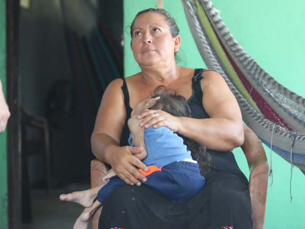 Alicia Isabel Solorzano nació el 23 de julio de 2016 en Choluteca. Los médicos dijeron que tenía microcefalia grave. La niña sufre en silencio, pues cuando llora no se le escucha ningún quejido, pero su rostro refleja angustia e incomodidad.