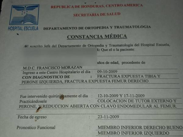 Dependiendo de cada caso, el paciente víctima de un accidente de moto se enfrenta a sufragar altos costos en implementos médicos para poder iniciar su recuperación.