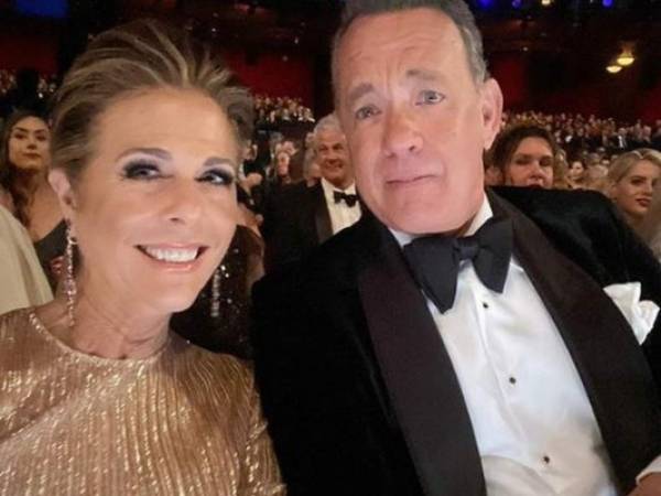 Tom Hanks y su esposa son los primeros famosos en contagiarse de coronavirus. Foto: Instagram