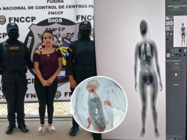 La mujer embolsó el paquete de marihuana y un anillo en un preservativo (foto inserta) que, a su vez, introdujo en su parte íntima. La imagen de la derecha es la captura del control por el escáner. Foto: Cortesía INP.