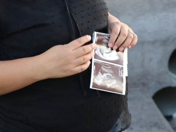 Daniel Fonseca nació en 2016. A los tres meses de gestación se enteró que su niño iba a ser discapacitado, pero fue hasta los ocho meses que le dijeron que era microcefalia por zika.