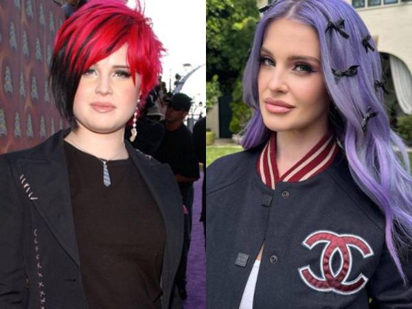 Kelly Osbourne, hija del famoso cantante de Rock Ozzy Osbourne, ha tenido un radical cambio físico que ha estado envuelto en polémica por asegurar que se sometió a varios procedimientos estéticos para lograr su nueva fisgura, sin embargo sostiene que no ha pasado bajo el bisturí.