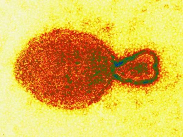 Se sabe que el henipavirus es detectado por medio de pruebas en la garganta.