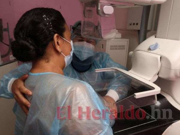 Funhocam ofrece mamografías gratis a pacientes de escasos recursos económicos. Foto: David Romero/El Heraldo