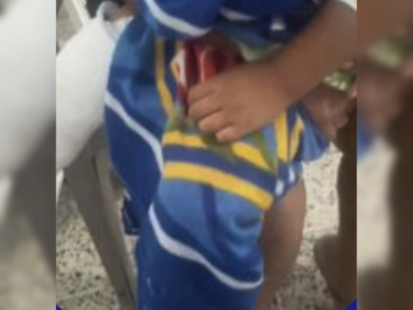 Un acto inhumano de un padre, producto de su comportamiento agresivo, provocó que su hijo menor perdiera tres de sus dedos en medio de un intento por atacar a su pareja en San Pedro Sula, Cortés. Aquí los detalles.