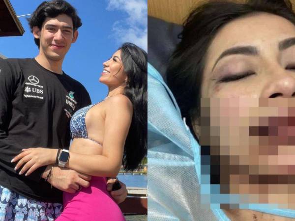 En las últimas horas se viralizó el caso de la modelo y tiktoker colombiana, Daniela Aldana Pinzón, residente en San Pedro Sula, quien fue víctima de una presunta agresión a manos de su novio, identificado como Isaac Sandoval, quien ya fue requerido por las autoridades. Se informó que aparte de golpearla, Sandoval habría intentado atropellar con su propio vehículo a la joven colombiana. A continuación los detalles del caso.