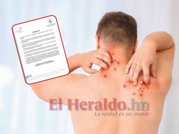 Dependiendo del nivel de exposición a probables contactos, según su ocupación, se recomienda que la persona utilice la careta facial en todo momento.