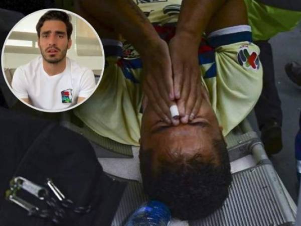 Giovani dos Santos fue operado de emergencia el domingo, un día después de sufrir la lesión en el clásico.