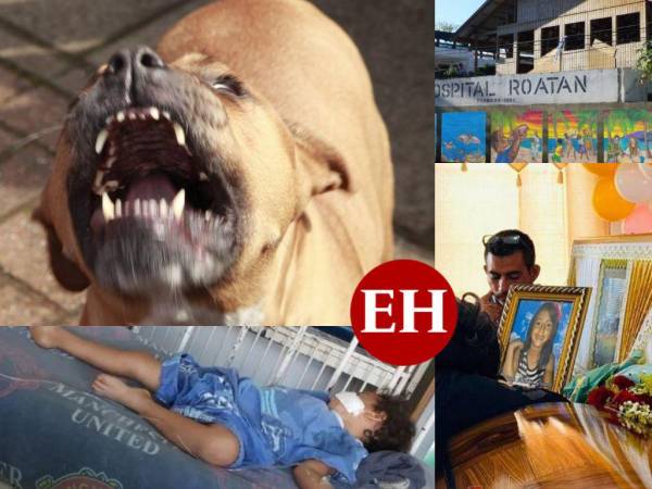 Solo en lo que va de este año (2022) se han reportado casi 20 pacientes con lesiones provocadas por mordedura de perros, la mayoría atendidos en el Hospital Escuela. Según las cifras oficiales, 13 de los heridos que han recibido atención médica han sido menores de edad y algunos casos han necesitado de más de una cirugía para recuperarse. Aquí un recuento.