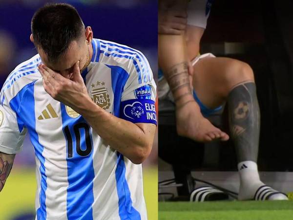 Leo Messi se lesionó con Argentina en la gran final ante Colombia por la Copa América 2024.