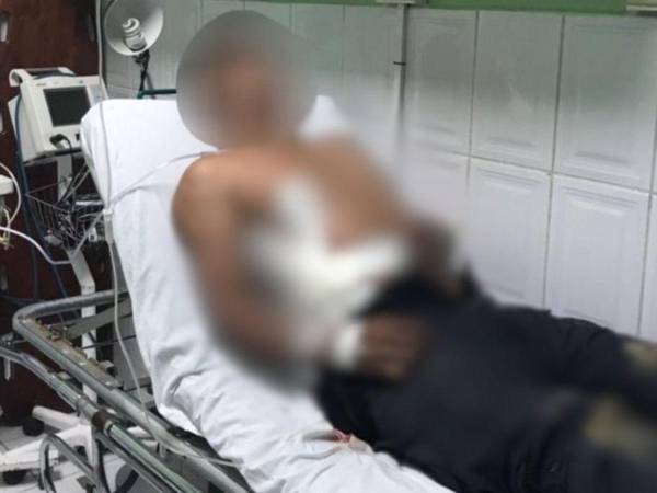 El agente policial recibió atención médica en Comayagua.