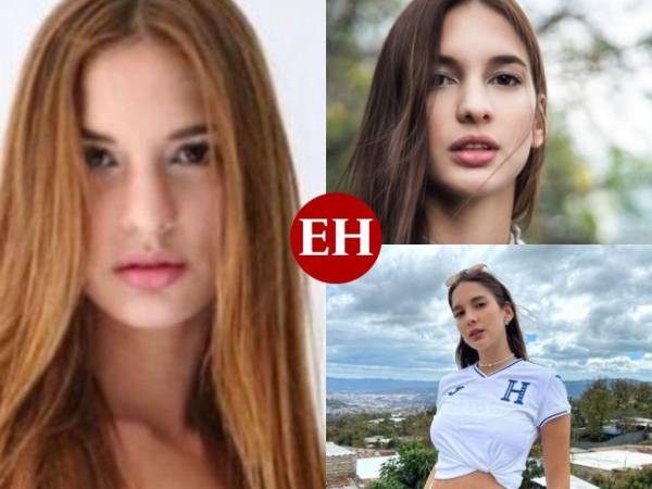 Ary ha sido muy abierta a hablar sobre sus cirugías estéticas. La modelo y empresaria se operó en México hace más de cuatro años. La venezolana asegura estar feliz con su cambio físico.