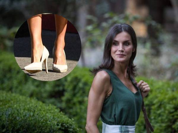 La reina Letizia padece de dos enfermedades en los pies.