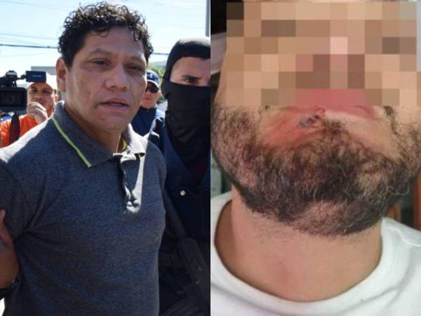 Óscar “Pescado” Bonilla fue uno de los reos que recibió una golpiza en la cárcel de Támara por parte de elementos de la Policía Militar del Orden Público (PMOP). ¿Por qué se dio el hecho? Dentro de la Policía Militar han justificado lo sucedido.