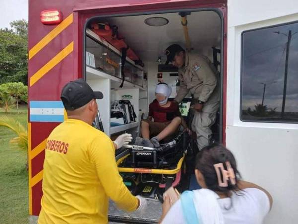 El menor de edad fue enviado al hospital de La Ceiba tras que los bomberos le removieran el pez de su cabeza.