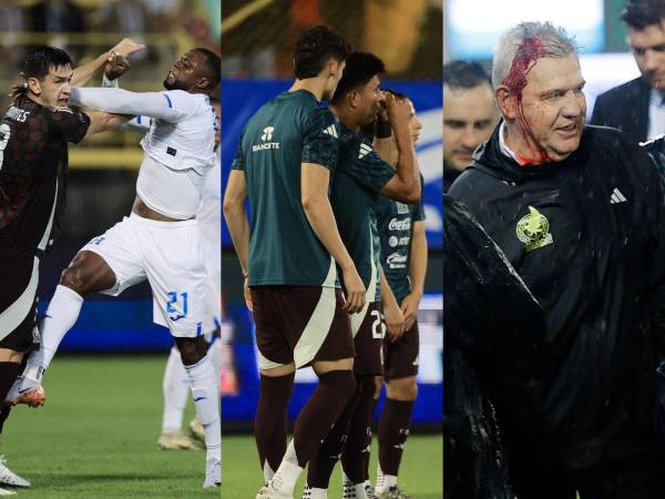 EN FOTOS: Javier Aguirre le sacó la madre a los aficionados de Honduras y jugador de México se burló de los hinchas catrachos. Las provocaciones del TRI en el Estadio Morazán.