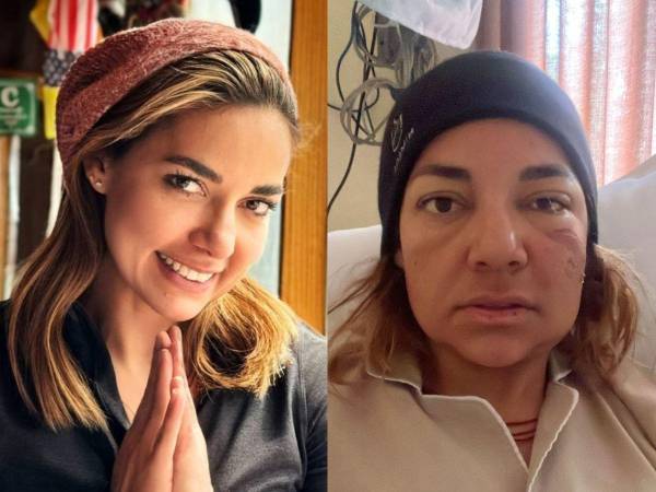 El impresionante logro de escalar el Monte Everest significa para Dora Raudales una de las mejores experiencias de su vida. Sin embargo, el reto le ha pasado factura a su condición física. A continuación, más detalles.