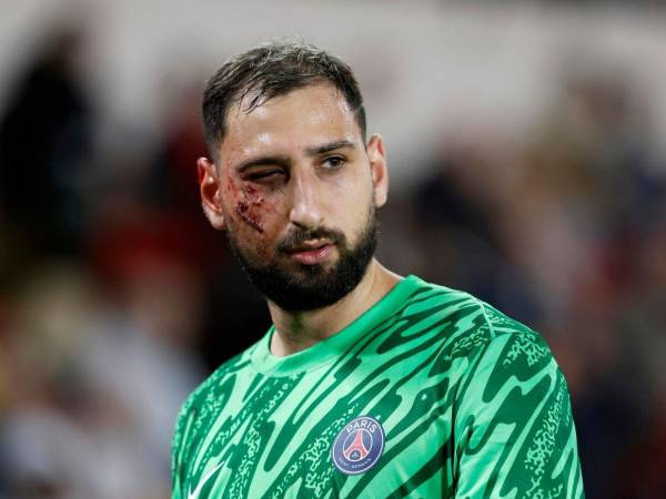 El PSG no ha entrado en detalles sobre cuánto tiempo estará Donnarumma inactivo tras la terrible lesión que sufrió ante el Mónaco.