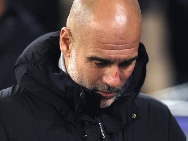 Pep Guardiola aclara las heridas en su rostro tras partido de Champions League.