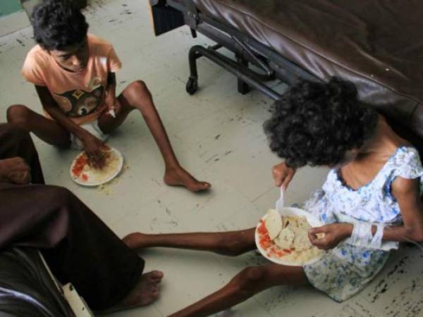 Al menos durante seis meses las gemelas estuvieron en tratamiento en el hospital, sin embargo, al parecer su padre abandonó (El Heraldo Honduras/ El Heraldo Sucesos).