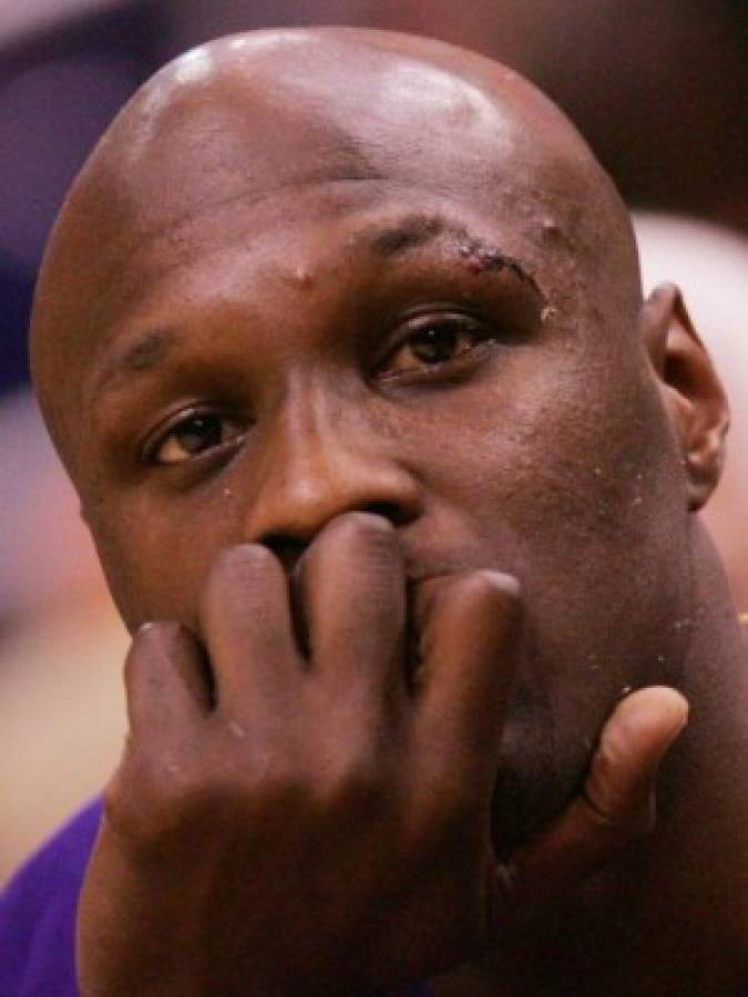 El último diagnóstico que hicieron a Lamar Odom