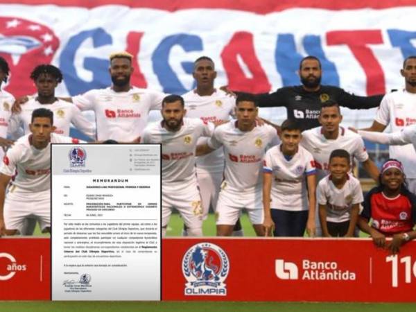 El Olimpia no quiere lidiar con más lesiones, es por eso que el club ha fijado su postura en relación a la participación de sus jugadores en ligas burocráticas.