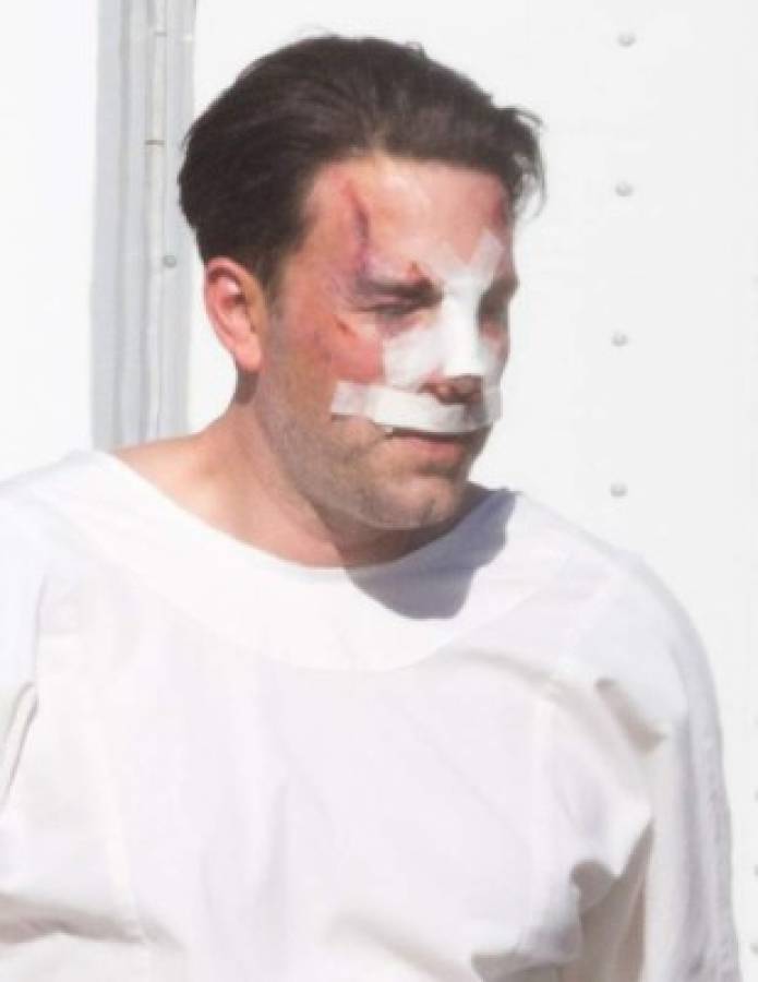 ¿Qué le pasó en la cara a Ben Affleck? ¿El actor se operó el rostro? (FOTOS)